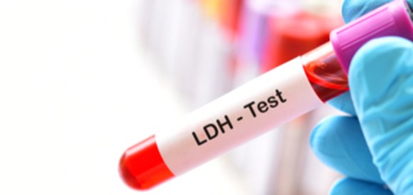 בדיקת Lactate Dehydrogenase) LDH) - תמונה